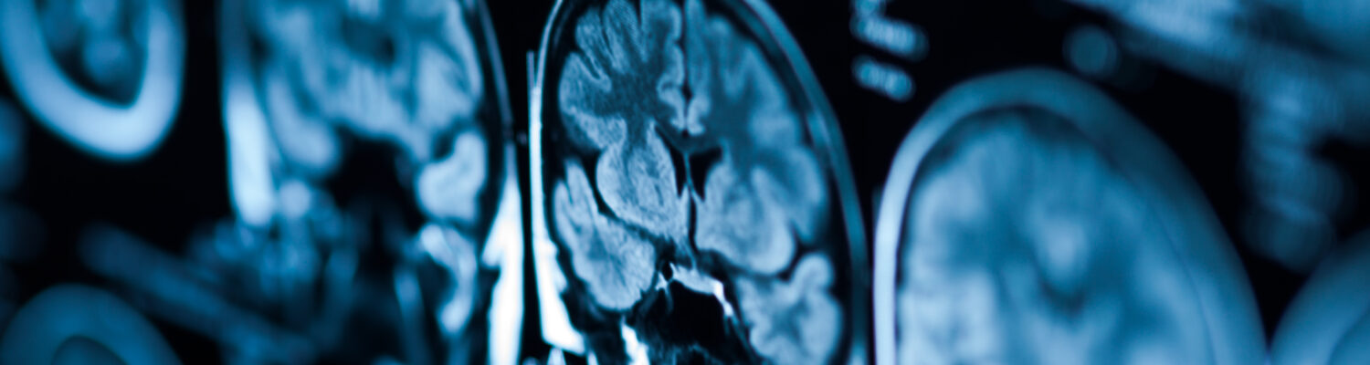 The X-ray of the human brain closeup image
