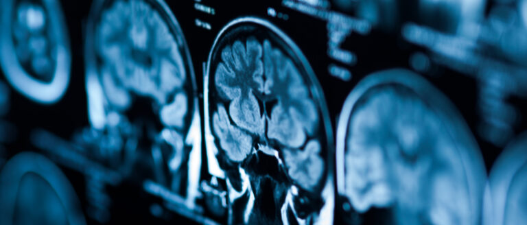 The X-ray of the human brain closeup image